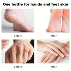 5Pcs Cherry Hand Cream Moisturizing for Dry Hands Travel Size Lotion