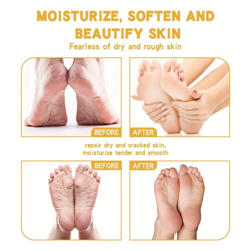 2pcs Moisturizing Foot Cream for Dry and Rough Skin