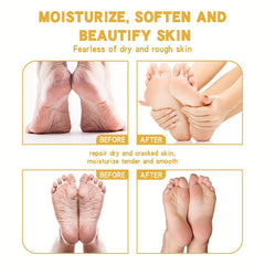 2pcs Moisturizing Foot Cream for Dry and Rough Skin