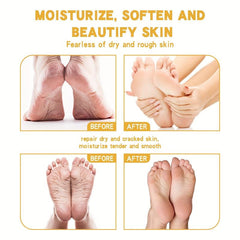 Moisturizing Foot Cream - Prevent Feet & Heel Cracks, Hydrate Skin