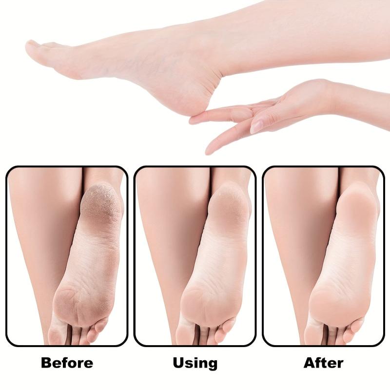 Stainless Steel Pedicure Foot File Scrubber with Replacement Pads