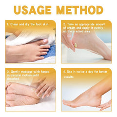 Moisturizing Foot Cream for Dry Rough Skin - Prevent Cracking