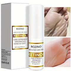 Retinol Hand Foot Care Cream for Dry Rough Skin - Moisturize & Nourish