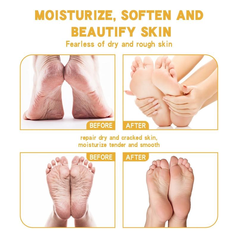 Moisturizing Foot Cream for Dry Cracked Skin