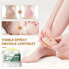 Eucalyptus Foot Cream - Softens Dry Rough Feet, Hydrates Hands & Elbows
