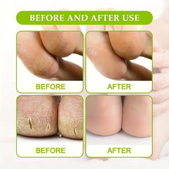Eucalyptus Foot Cream - Softens Dry Rough Feet, Hydrates Hands & Elbows