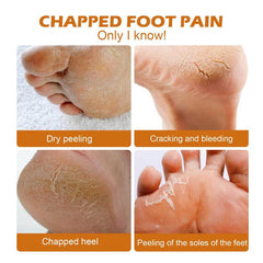 Horse Foot Cream Heel Callus Removal Balm