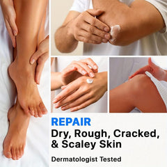 Urea Cream 40 Plus Salicylic Acid 2 Foot Cream For Dry Cracked Feet