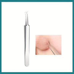 Blackhead & Whitehead Remover Tweezers - Acne Blemish Pimple Extractor