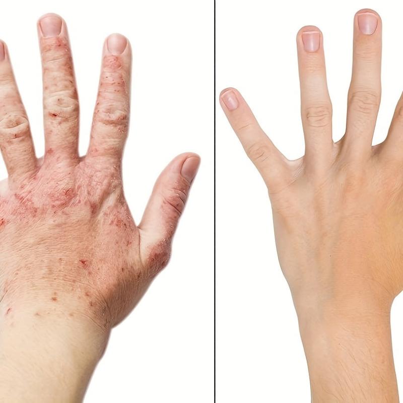 1 Pair Moisturizing Cotton Gloves Men Women Soft Breathable Hand Care Gloves