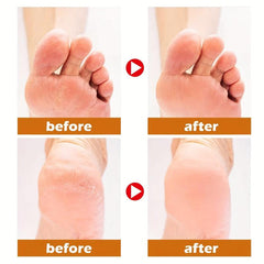 Horse Foot Care Cream for Repairing Dry Heels