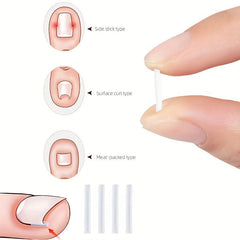 20 Pcs Ingrown Toenail Corrector Strips Foot Corrector Brace Nail Art Sets