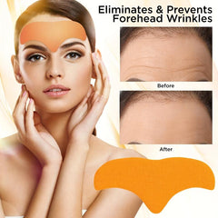 10 Pcs Forehead Patches with Hydrolyzed Collagen for Smooth Skin