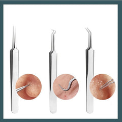 Blackhead Splinter Remover Tweezers Stainless Steel