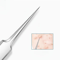 Blackhead Splinter Remover Tweezers Stainless Steel