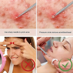 1pc Blackhead Remover Acne Needles Stainless Steel Tool