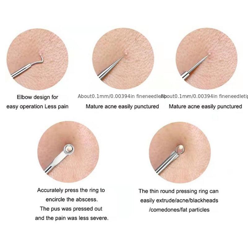 4PCS Blackhead Acne Remover Comedone Spot Blemish Pimple Removal Needle