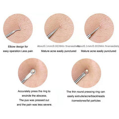 4PCS Blackhead Acne Remover Comedone Spot Blemish Pimple Removal Needle