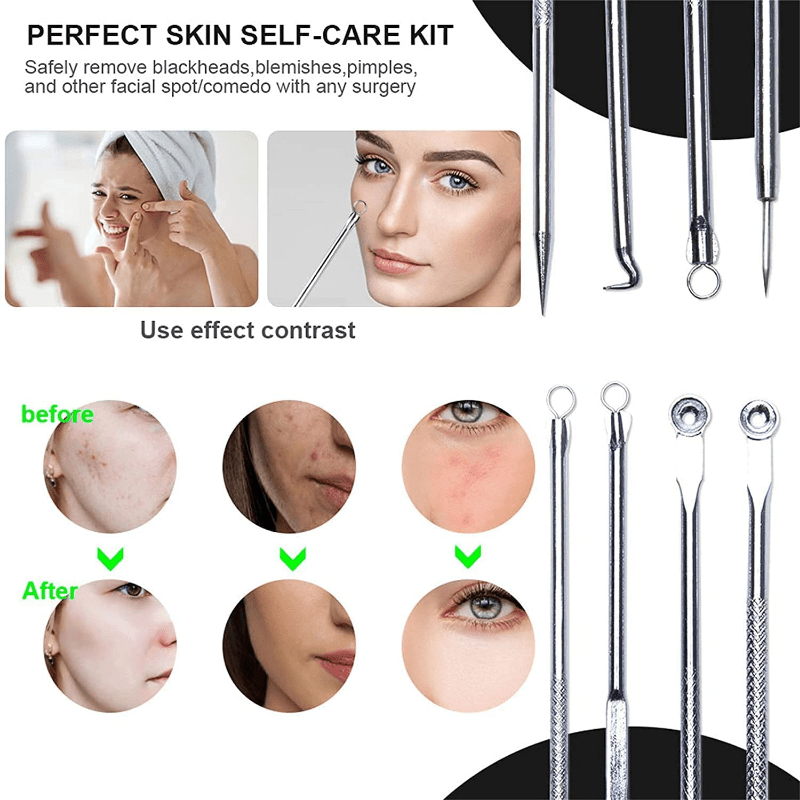 4PCS Blackhead Acne Remover Comedone Spot Blemish Pimple Removal Needle