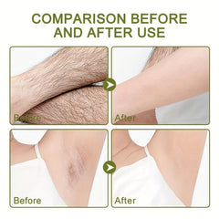 Gentle Olive Hair Removal Cream Underarms Lips Sensitive Formula