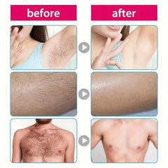 Gentle Hair Removal Cream for Smooth Skin