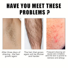 Men's Intimate Hair Removal Cream