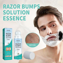 Razor Bumps Serum Ingrown Repair Roll On Men Women 100ml