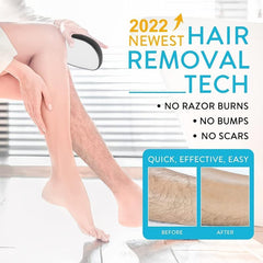Crystal Hair Eraser Painless Hair Remover for Women & Men