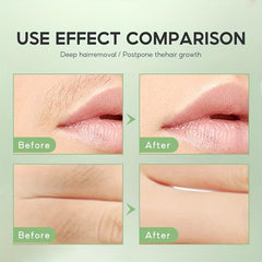 Facial Wax Strips Hair Removal Kit