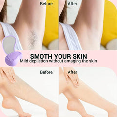 Hair Removal Crystal Hair Eraser For Smooth Legs, Back & Arms