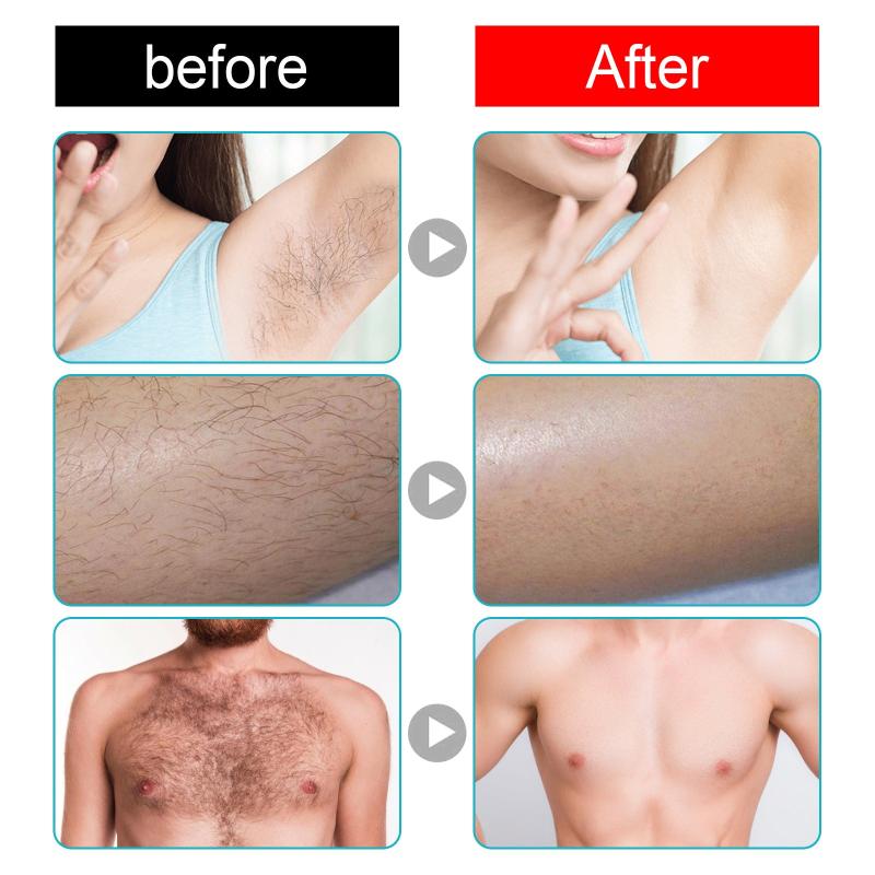 Hair Removal Cream For Women And Men Leg & Bikini Hair Removal