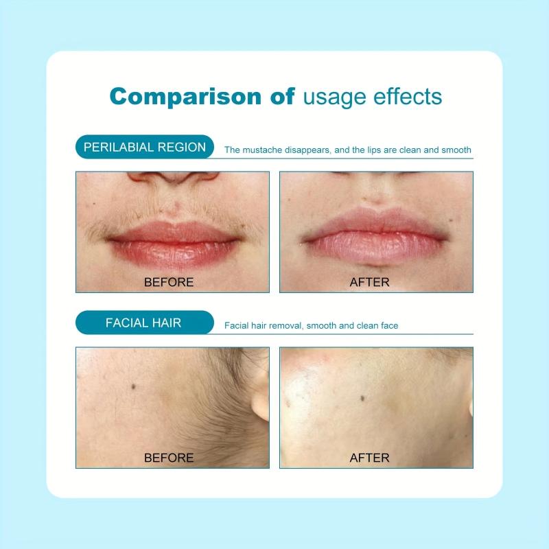 Hair Remover For Women Skin-Friendly Painless Flawless Hair Remover