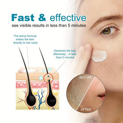 Hair Remover For Women Skin-Friendly Painless Flawless Hair Remover