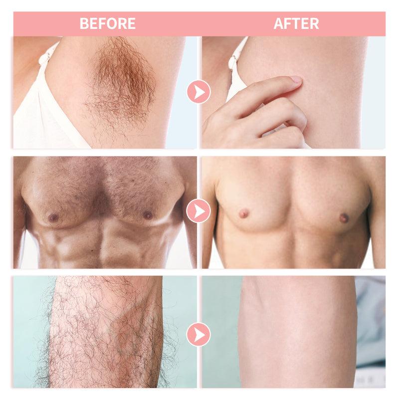 40 Hypoallergenic Wax Strips for Painless Hair Removal All Skin Types