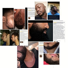 Natural Beard Growth Serum - 2 Month Supply