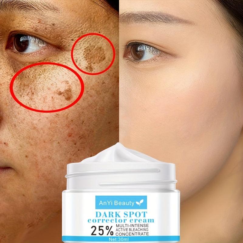 Dark Spot Corrector Cream - Fade Hyperpigmentation, Blemish Cover