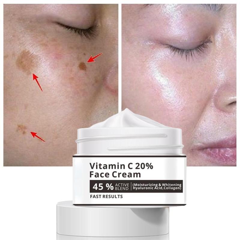 Hydrating Freckle Cream Corrects Dark Spots