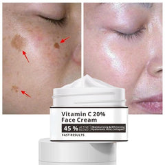 Hydrating Freckle Cream Corrects Dark Spots
