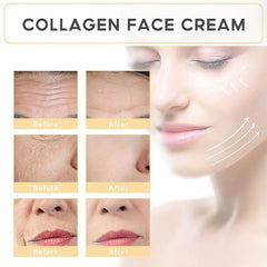 Advanced Clinicals Collagen & Hyaluronic Acid Face & Body Set