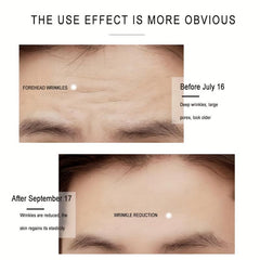 Vitamin C Wrinkle Diminishing Cream