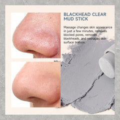 Blackheads Remover Stick Deep Pore Cleanse | All Skin Types
