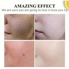 Natural Dark Spot Remover For Face And Body Enriching Skin Care