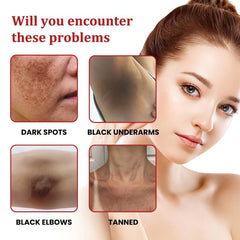 Natural Dark Spot Remover For Face And Body Enriching Skin Care