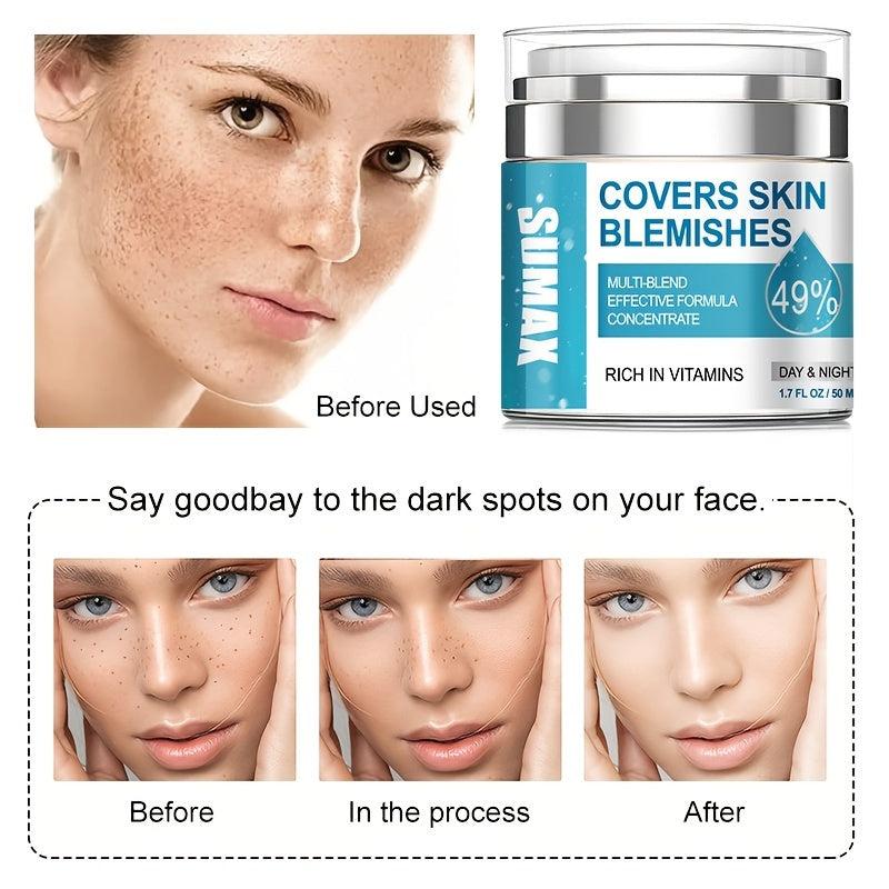 Dark Spot Remover for Face & Body - Melasma Freckle Sun Spot & Blemish Reducer
