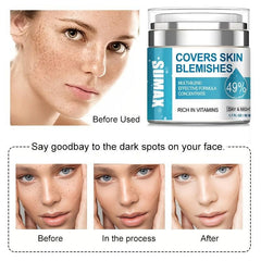 Dark Spot Remover for Face & Body - Melasma Freckle Sun Spot & Blemish Reducer