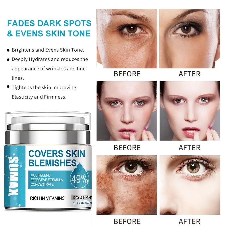Dark Spot Remover for Face & Body - Melasma Freckle Sun Spot & Blemish Reducer
