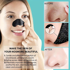 Bamboo Charcoal Nose Stick Blackhead Removal Mask for Men and Women