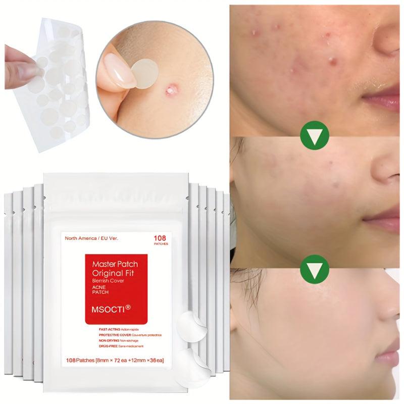 Snail Essence Acne Pimple Patch Natural and Effective