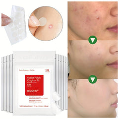 Snail Essence Acne Pimple Patch Natural and Effective
