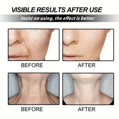 Skin Tightening Cream for Chest Neck and Face